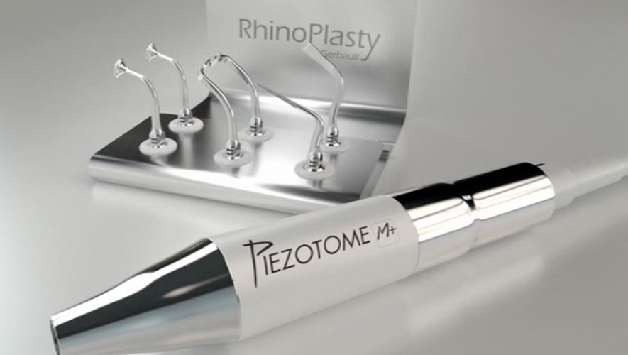 Rhinoplasty ultrasonique